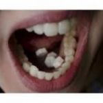 DURBAN )][@][(^ ^) VIP, GENUINE, UNIQUE +27835179056 PILLS E~^££ ABORTION IN STANGER DURBAN PINETOWN