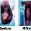 Registered MENS CLINIC ,27793478685 Penis enlargement cream//pills in Bhisho, (previously Bisho) raunschweig Burgersdorp Cathcart Dohne
